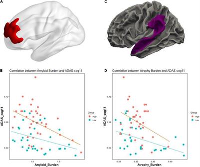 Effects of Cognitive Reserve in Alzheimer’s Disease and Cognitively Unimpaired Individuals